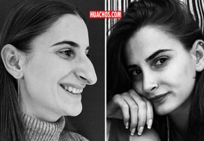 Renipress brinda información sobre lugares autorizados para realizar cirugías estéticas Renipress brinda información sobre lugares autorizados para realizar cirugías estéticas