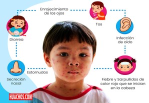 OMS hace llamado a padres de familia para que vacunen a sus hijos e hijas contra el sarampión OMS hace llamado a padres de familia para que vacunen a sus hijos e hijas contra el sarampión