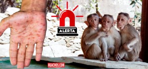 OMS declara emergencia de salud mundial por un nuevo brote de viruela del mono | VIDEO OMS declara emergencia de salud mundial por un nuevo brote de viruela del mono | VIDEO