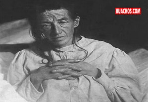 Cómo se descubrió el alzhéimer: el primer caso diagnosticado cumple 110 años Cómo se descubrió el alzhéimer: el primer caso diagnosticado cumple 110 años