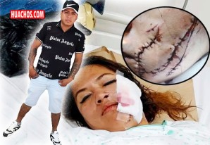 Por despecho, un sujeto, corta con una chaira la cara de su ex-enamorada Por despecho, un sujeto, corta con una chaira la cara de su ex-enamorada