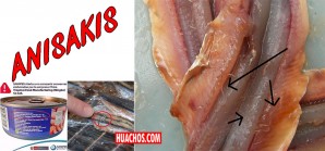 Anisakis, es probablemente el parásito que se encuentra en las conservas chinas Anisakis, es probablemente el parásito que se encuentra en las conservas chinas