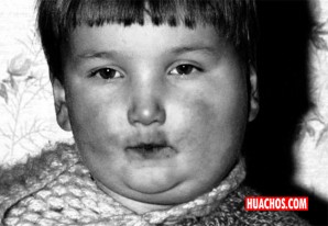 Niños que no recibieron dosis de SPR están expuestos a contraer paperas Niños que no recibieron dosis de SPR están expuestos a contraer paperas